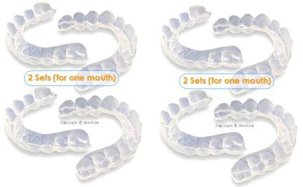 15. Touch of White, Teeth Whitening Kit